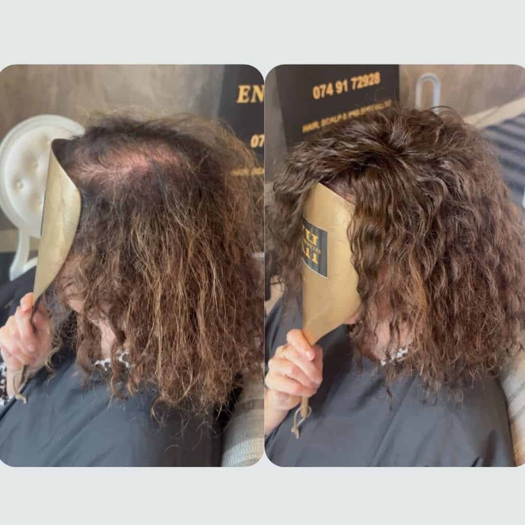 Before and after: KHG Hair Enhancers hair topper result for a client with thinning hair